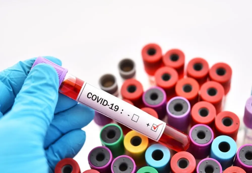 Până în acest moment nu există niciun cetățean român pentru care să fi fost confirmată infectarea cu virusul COVID – 19 (coronavirus)