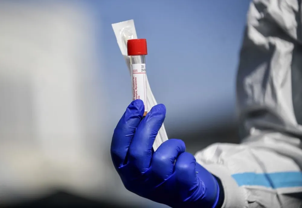 Bilanț coronavirus 19 august. Noile cifre anunțate oficial: 1.409 cazuri noi, 32 de decese