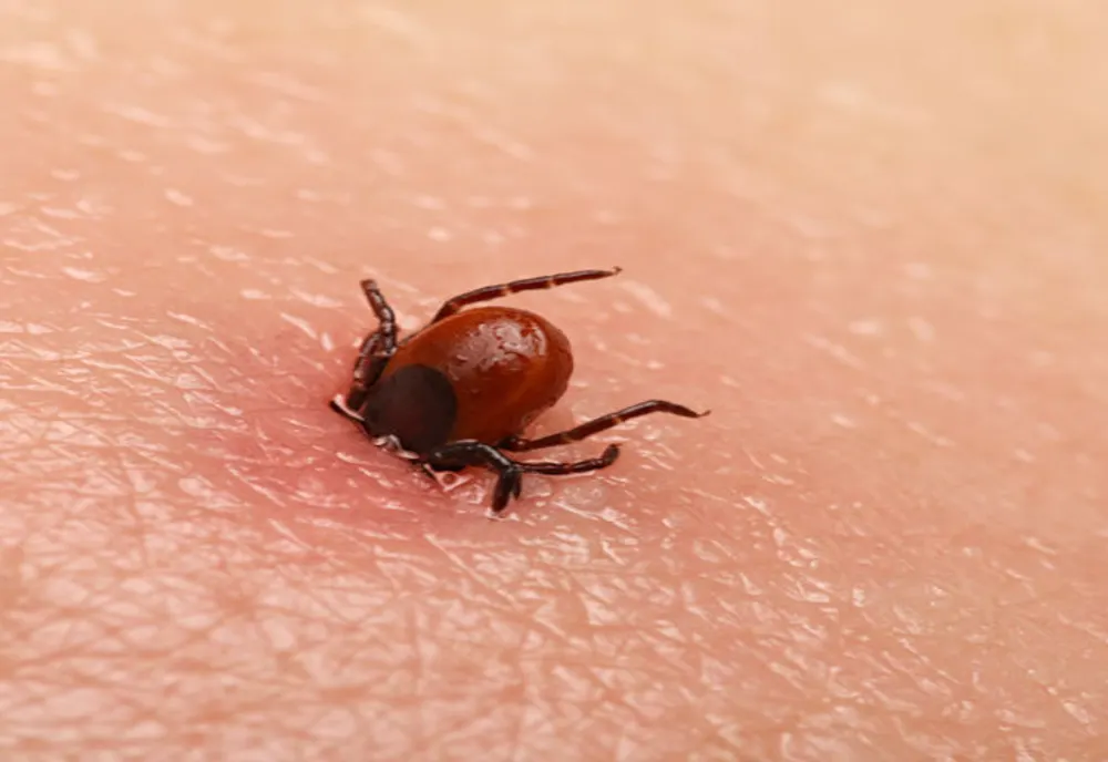 Boala Lyme și ce pericole are mușcătura de căpușă