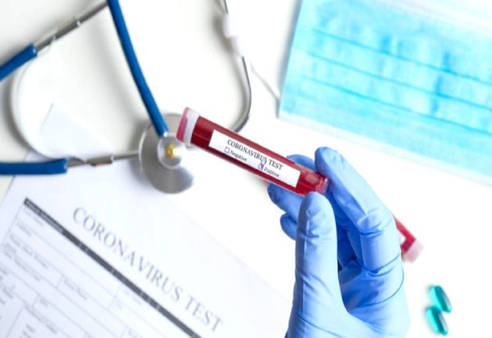  Nouă cazuri noi de CoVid-19 în Călărași în ultimele 24 de ore