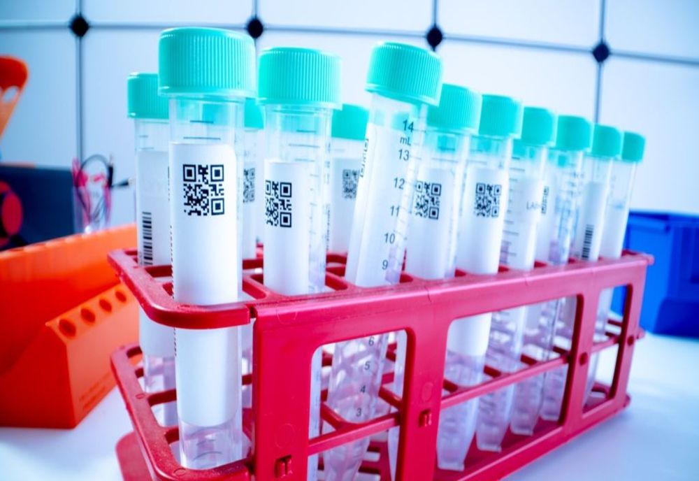 TESTARE GRATUITĂ ȘI ANONIMĂ PENTRU HIV ȘI HEPATITE LA TREI SPITALE DIN BUCUREȘTI