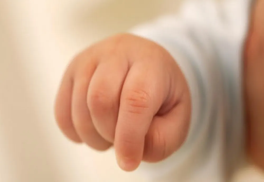 Anchetă la Spitalul Elias, după apariția în spațiul public a imaginilor care surprindeau momentul nașterii bebelușului cu două capete